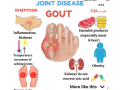 gout-solution-small-3